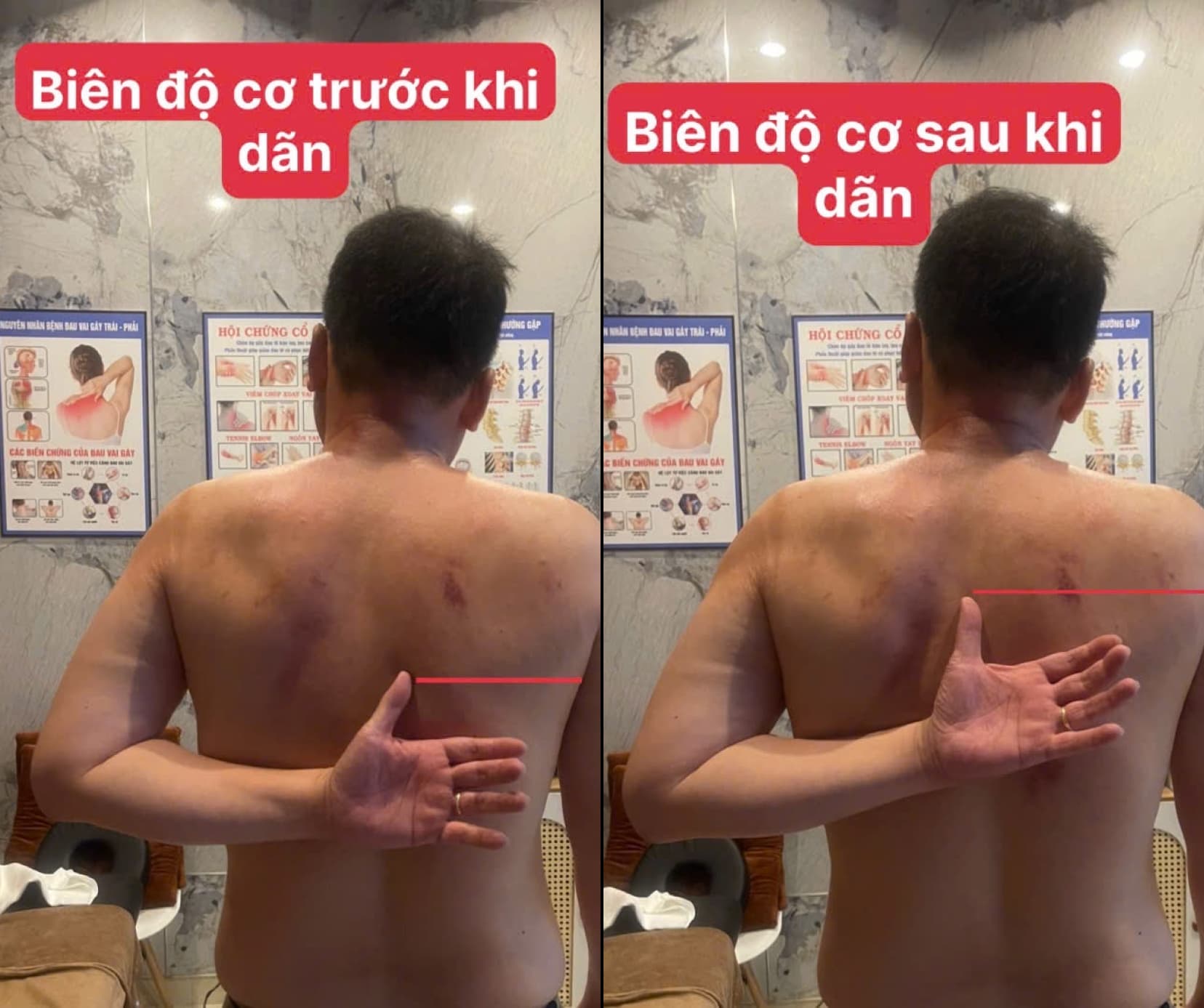 Dãn cơ & Phục hồi cơ